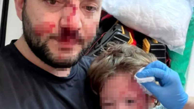 Yalova'da Bebek ve Babasına Saldırı: İstenen Ceza 12-36 Yıl Arası Hapis