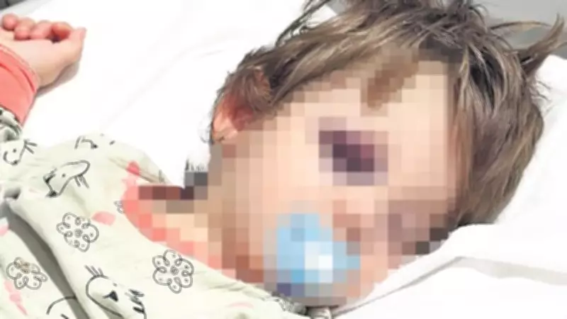 Yalova'da Komşu Korkusu: Baba ve 14 Aylık Kızına Odunla Vahşi Saldırı