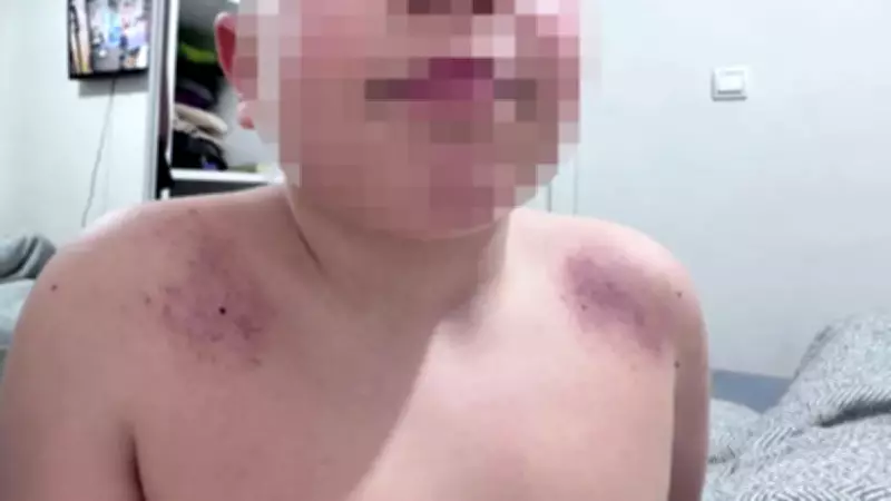 Antalya'da Öğretmen Dehşeti: 8 Yaşındaki Öğrenciyi Darbetti İddiası!