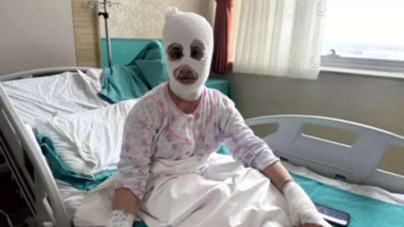 Ağrı'da İftar Hazırlığında Patlayan Düdüklü Tencere İki Çocuk Annesini Yanık Merkezine Ulaştırdı