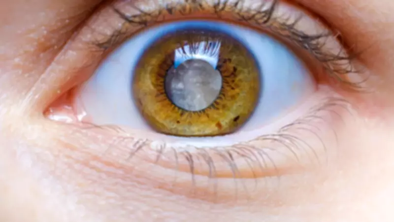 Doktorlar Uyarıyor: Glokom Göz Sağlığını Sessizce Yok Ediyor!