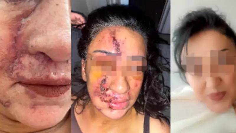 Estetik Operasyonu Sonrası Yaşamını Yitiren Genç Kadınla İlgili Soruşturma Başlatıldı