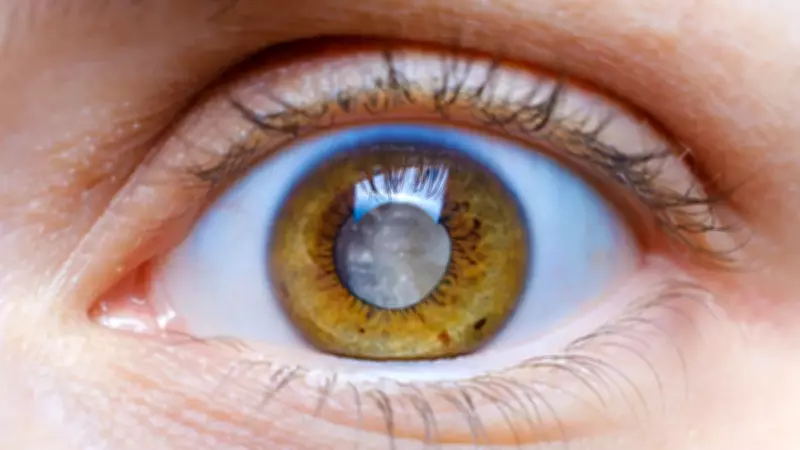 Glokom Tehlikesi: Milyonlar Farkında Değil, Görme Kaybı Riski Büyüyor