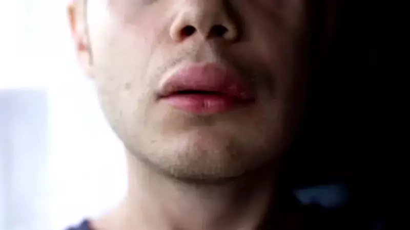 Herediter Anjioödem Hastalığında Türkiye'de 1500'e Yakın Kayıtlı Hasta Bulunuyor