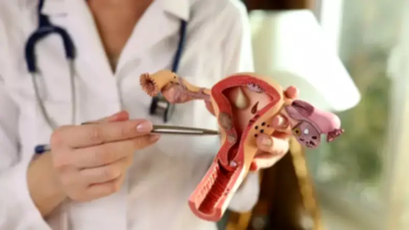 Çikolata Kisti 200 Milyon Kadını Etkiliyor: Uzman Erken Tanının Önemini Vurguluyor