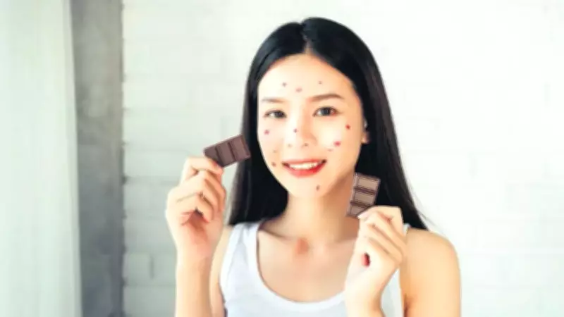 Çikolata Sivilce Yapar mı? Uzmanlar Yanıt Verdi