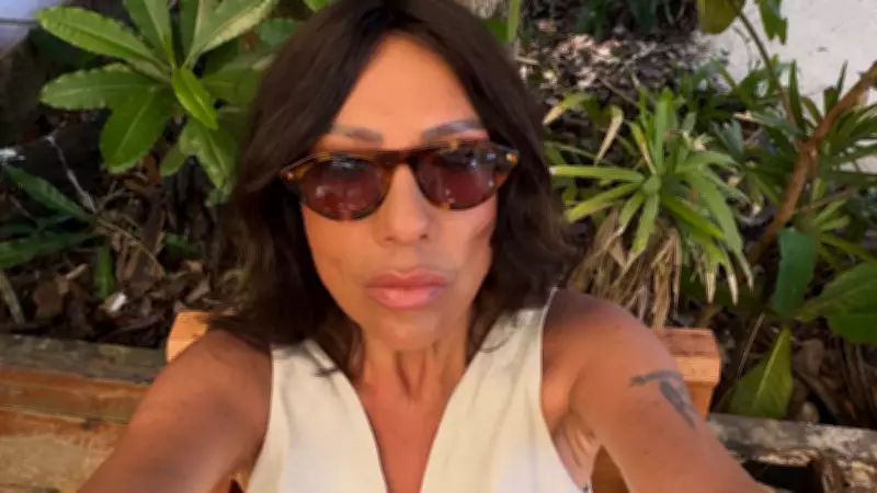 Işın Karaca'nın Aşırı Zayıflığı Hayranlarını Endişelendirdi