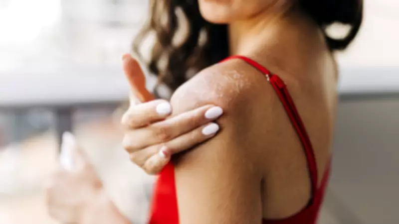 iPhone Sağlık Uygulamasındaki Fitzpatrick Cilt Tipi Sorusunun Anlamı ve Önemi