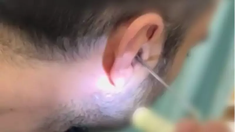 Kayseri'de Şüpheli Kişinin Kulağından Uyuşturucu Çıktı