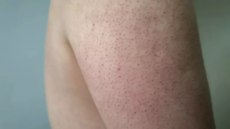 Kollardaki Pütürlerden Kurtulun: Tavuk Derisi Görünümüne Çözüm