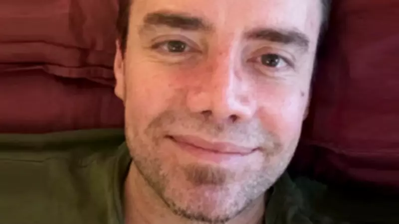 Murat Dalkılıç Bandajlarını Çıkardı: Burun Ameliyatı Sonrası İlk Açıklama