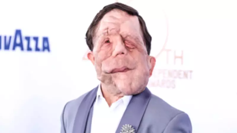 Oscar'ın Yıldızı Adam Pearson: Önyargıları Mizahla Yerle Bir Etti