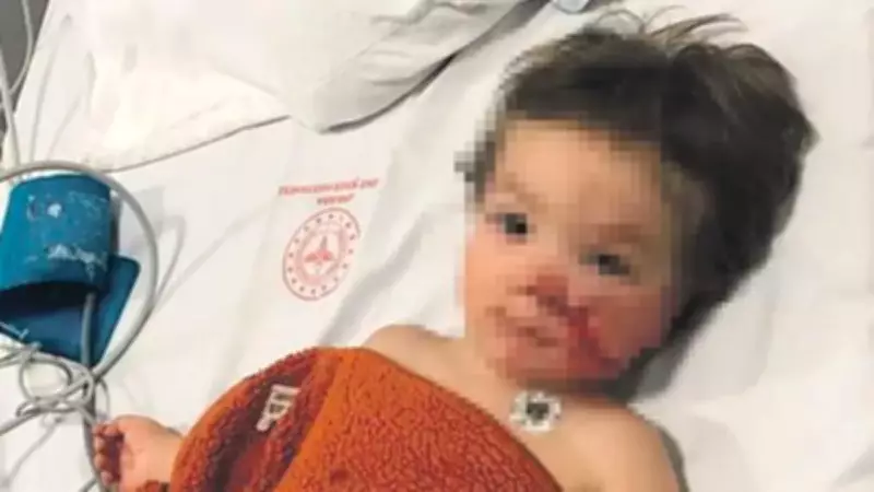 Pitbull Saldırısında Yaralanan 2 Çocuk İçin Köpek Sahibine Hapis İstemi