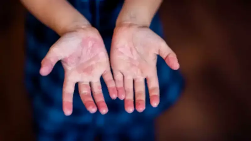 Prof. Dr. Eminoğlu: Nadir Hastalıklar 5-6 Milyon Kişiyi Etkiliyor