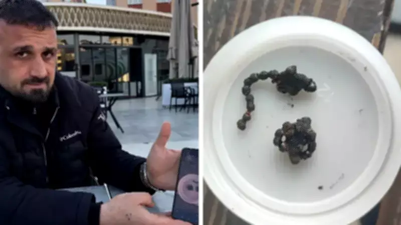 Rize'de 5 Yaşındaki Kızın Burnundan Tırnak Makası Zinciri Çıkarıldı