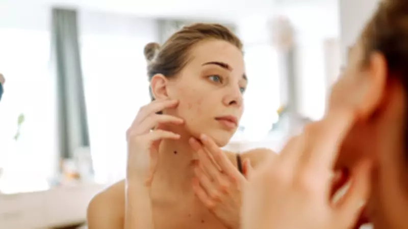 Sivilceler Cildi Yaşlanmaya Karşı Koruyabilir: Şaşırtıcı Araştırma Sonuçları