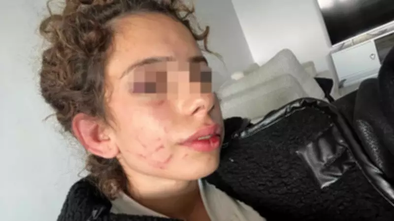 Sıla'ya Dehşet Yaşatan Eski Sevgiliye Ağır Ceza Davası Açıldı