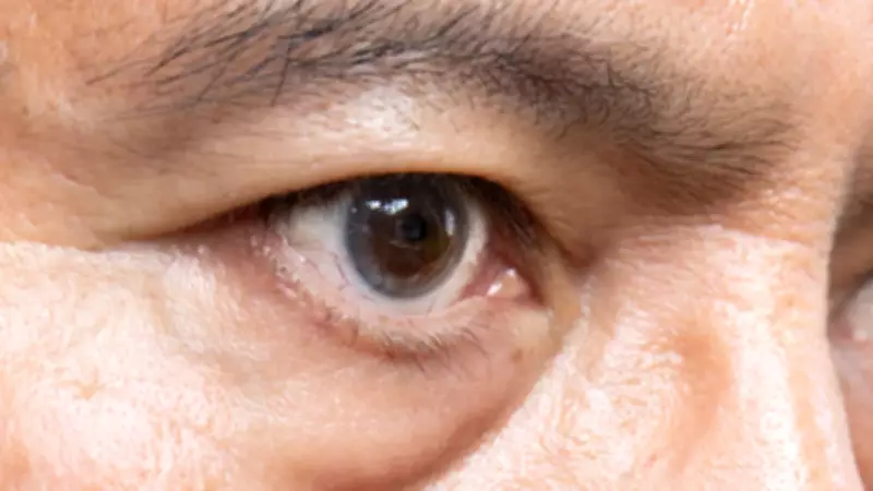 Türkiye'de 2 Milyon Kişi Glokom Tehlikesiyle Yaşıyor: Sinsi Hastalık Fark Edilmiyor