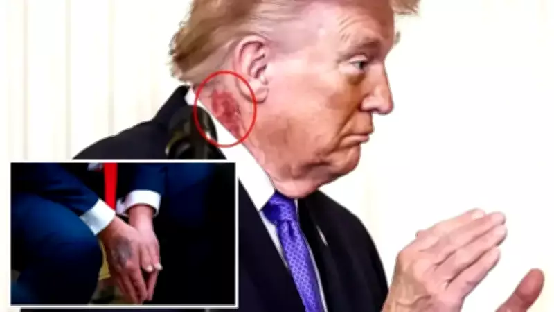 Trump'ın Boynundaki Kızarıklık Kremdenmiş: Doktoru Açıkladı