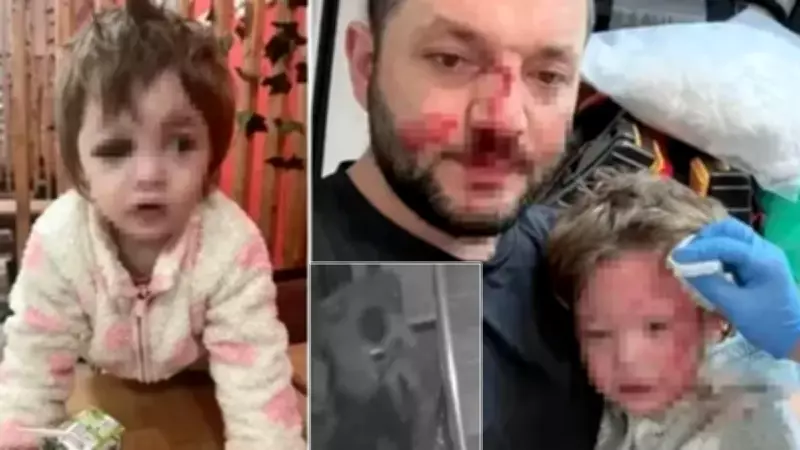 Yalova'da Baba ve Bebek Saldırısında Yeni Görüntüler: İkra'nın Kafatasında Çatlak