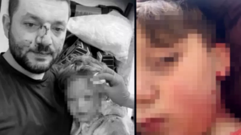 Yalova'da Komşu Kavgası: Baba Evini Satışa Çıkardı, Oğlu Taşla Yaralandı