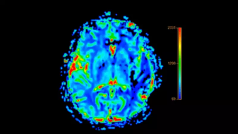 Yapay Zeka Alzheimer Teşhisinde %93 İsabetle Devrim Yaptı