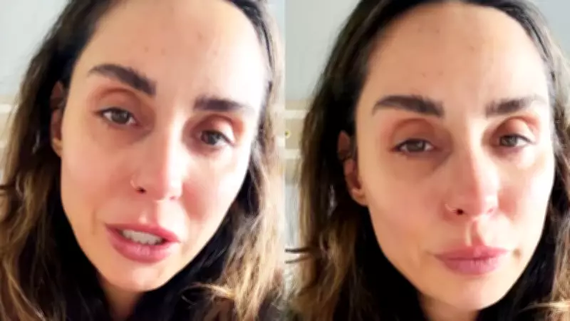 Yasemin Yürük'ün Kaza Sonrası Duygusal Açıklamaları: 'Herkesi Tanıma Fırsatım Oldu'