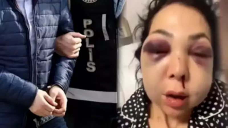 İzmit'te Anne ve Oğluna Saldırı: Uyarı Yapan Genç ve Annesi Darp Edildi, 1 Tutuklama