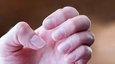 Bilim İnsanları Uyardı: Tırnaklardaki Bu Değişim Kanserin Erken İşareti Olabilir!