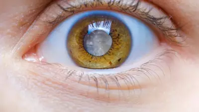 Doktorlar Uyarıyor: Glokom Göz Sağlığını Sessizce Yok Ediyor!