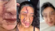 Estetik Operasyonu Sonrası Yaşamını Yitiren Genç Kadınla İlgili Soruşturma Başlatıldı