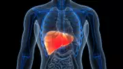 Karaciğer Kanseri Önlenebilir: Uzmanından Kritik Uyarılar ve Korunma Yöntemleri
