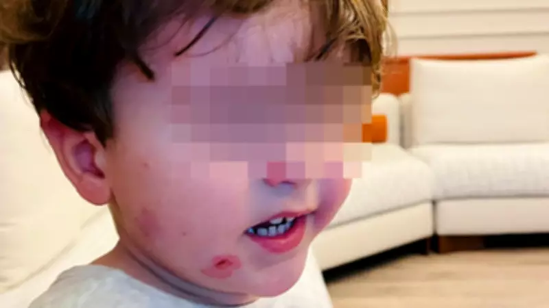 Bursa'da 2,5 Yaşındaki Çocuk Kreşte Darp Edildi: Gözetmen Öğretmen Yoktu