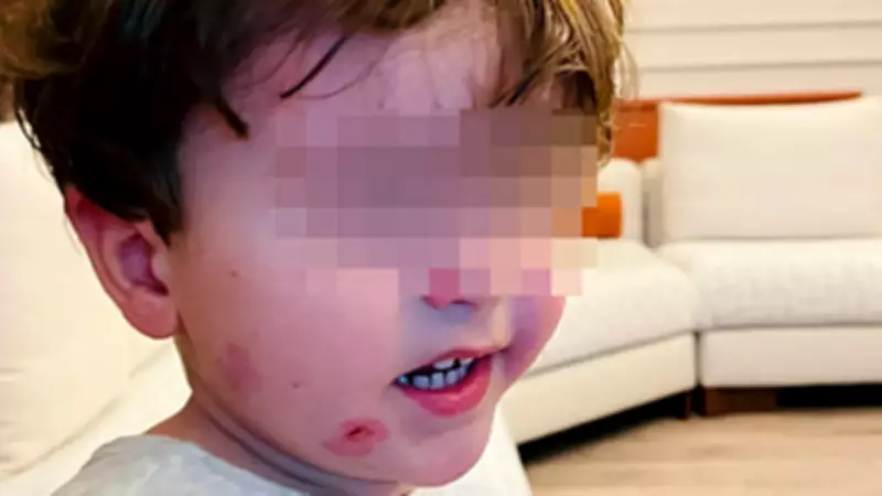 Bursa'da Kreş Skandalı: 2,5 Yaşındaki Çocuk Darp Edilmiş Halde Bulundu