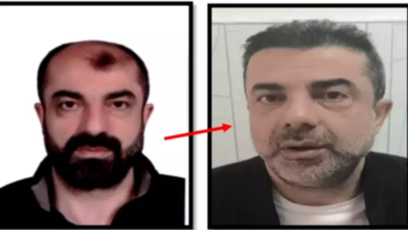 Cinayet Sonrası Estetikle Yüzünü Değiştiren Barış Mirza Yakalandı