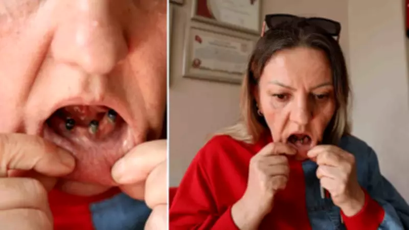 Diş ağrısıyla gitti, 25 dişi çekildi: İmplant mağduru kadın adalet arıyor