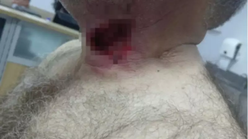 Diyarbakır'da at sahibini boğazından ısırarak ağır yaraladı