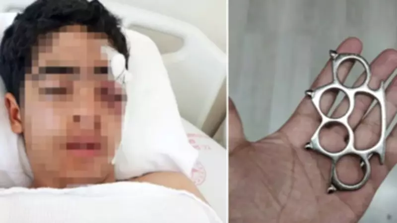 Esenyurt'ta akran şiddeti: 15 yaşındaki Bünyamin muştalı saldırıda ağır yaralandı