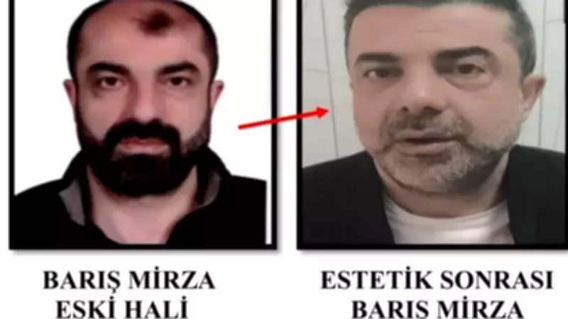 Estetik Ameliyatla Kardeşine Benzeyen Cinayet Zanlısı Polis Operasyonuyla Yakalandı