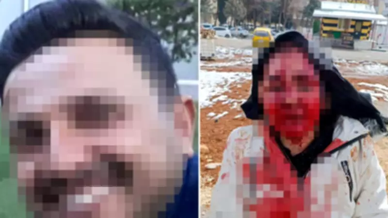 Gaziantep'te Boşanma Sürecindeki Eşini Kaldırım Taşıyla Darp Eden Sanığın Dosyası Ağır Cezaya Gönderildi