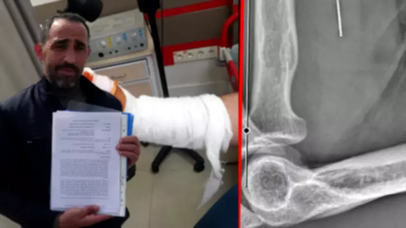 Kocaeli'de Kurban Bayramı Kazası: Yanlış Tedavi İddialarıyla Parmağını Kaybeden Adamın Dramı