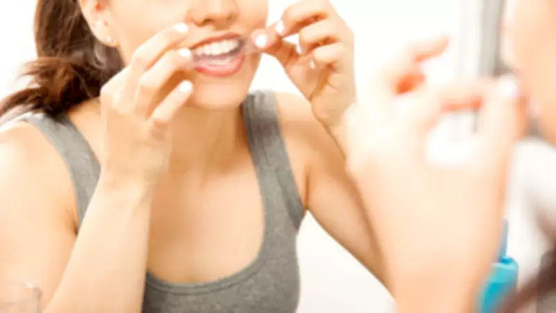 Masum Görünen Diş Beyazlatıcılar Büyük Tehlike Saçıyor: Diş Kaybına Yol Açabilir