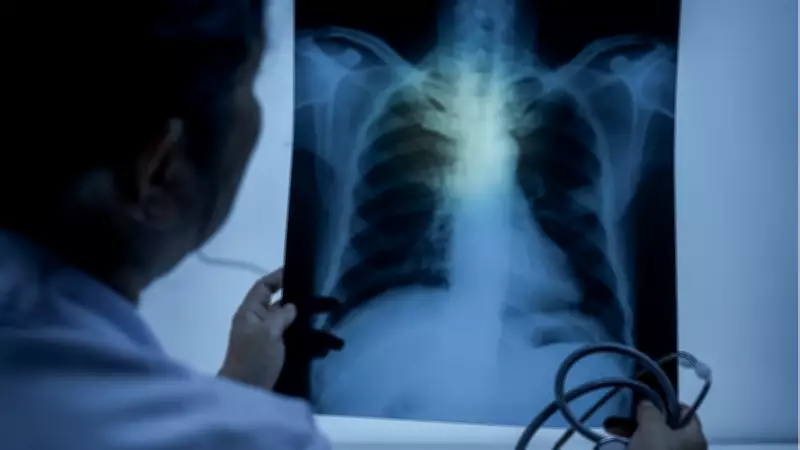 Ortadoğu'daki Savaşın Zehirli Dumanı Türkiye'ye Ulaşıyor: Akciğer Sağlığı Alarm Veriyor