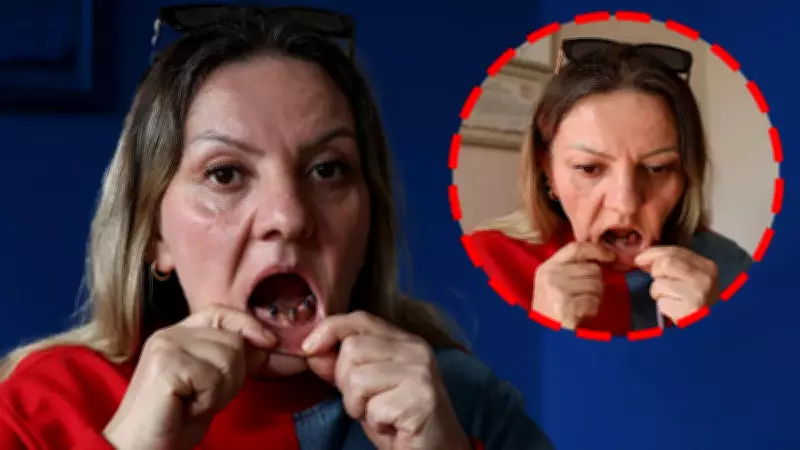 Sivas'ta 25 dişi çekilen kadının çenesinde iltihap oluştu