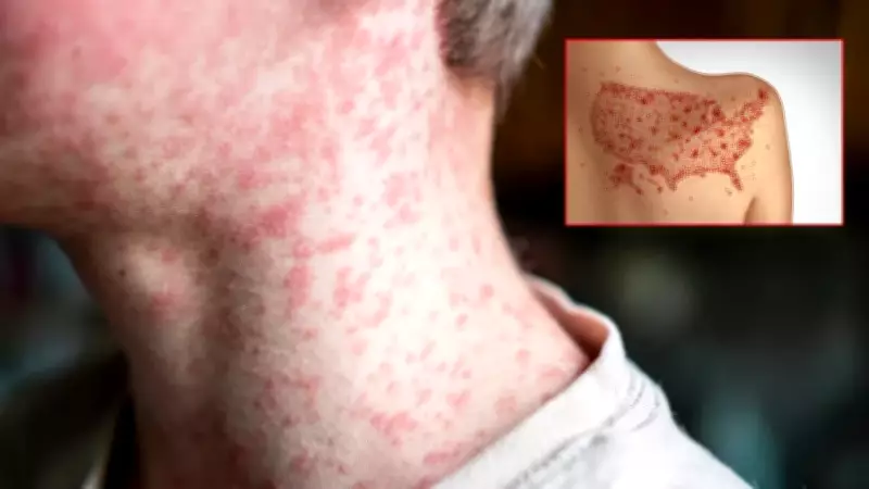 İstanbul'da sağlık yatırımları sürüyor, kızamık riski yok