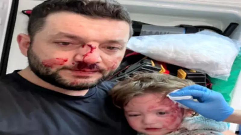 Yalova'da baba ve 14 aylık İkra bebeğe saldırı davasında yeni gelişmeler