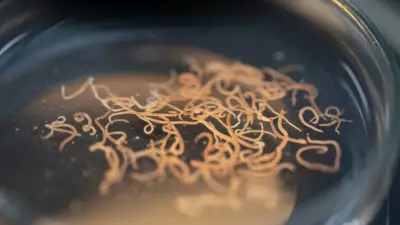 Kan Emici Parazitler Otoimmün Hastalıklara Çare Olabilir