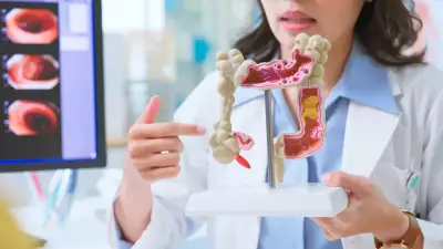 Uzmanlardan Kritik Uyarı: Kolon Kanseri Gençlerde Hızla Artıyor