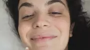 Aslı Bekiroğlu Yedinci Ameliyat Sonrası Sağlık Durumunu Açıkladı