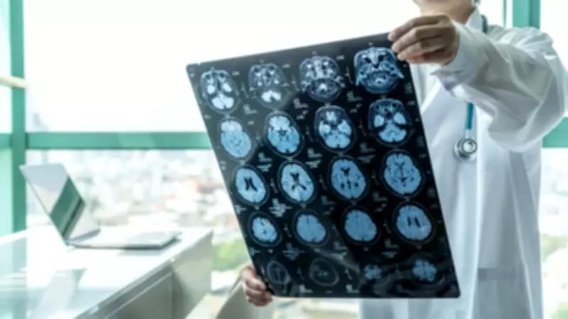 Beyni 20 Yıl Yaşlandıran Hata! Alzheimer İlk Sinyali 30'lu Yaşlarda
